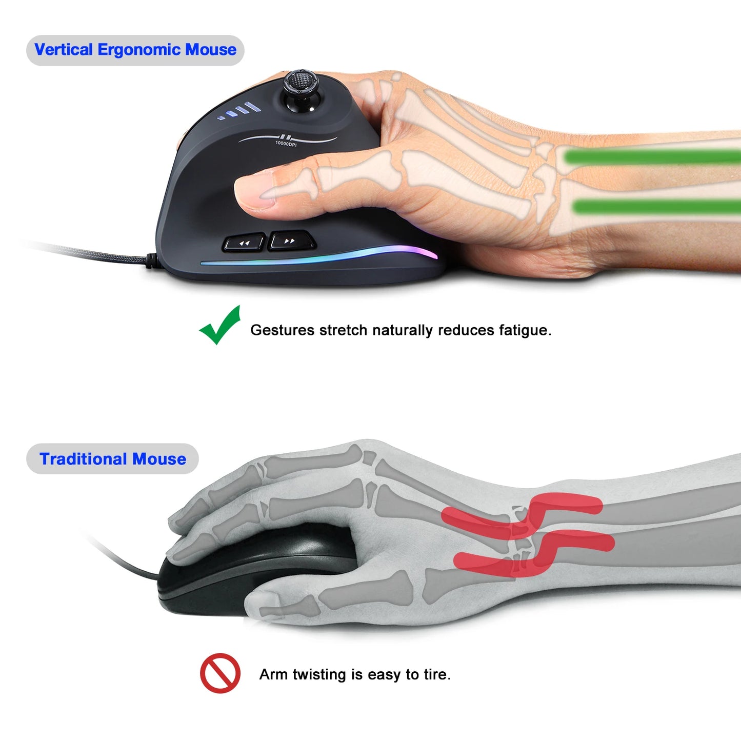 ZELOTES Vertical Gaming Mouse Wired USB Ergonomic Mice RGB Joysticks Programmable Laser Mice 10000 DPI For Gamer PC Computer C18